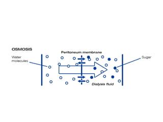 Dialysis Ppt Ppt