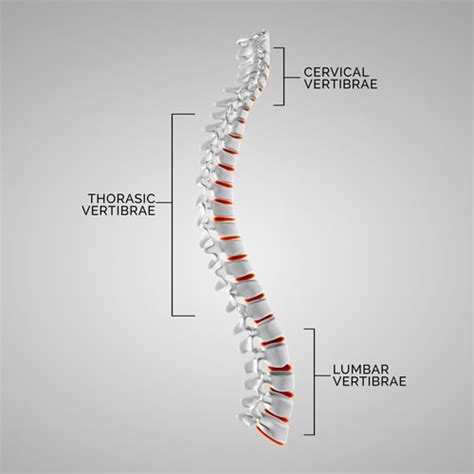 Ankylosing Spondylitis Bechterews Disease A Pain In The Back