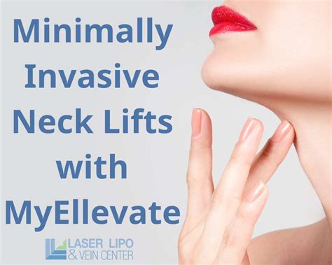 Minimally Invasive Neck Lifts With Myellevate St Louis Lipo