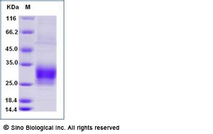 Recombinant Human CREG1 Protein 16497 H08H Sino Biological