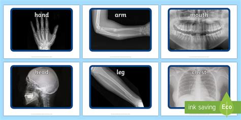 Human Body X Ray Photos Display Resources Teacher Made