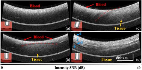 Psoct Intensity Images Guiding Catheter Tissue Apposition The Figure