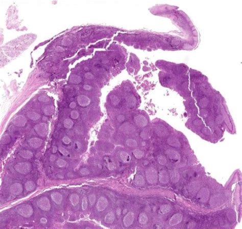 Oral Histo Embryo Final Oral Mucosa Flashcards Quizlet