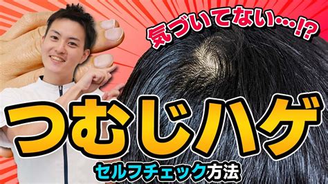 【手遅れになる前に】つむじハゲをチェックする3つのポイント！ Youtube