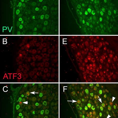 Parvalbumin Green And Atf3 Red Staining In The Ipsilateral L4 A