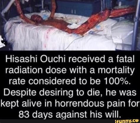 Hisashi Ouchi Received A Fatal Radiation Dose With A Mortality Rate