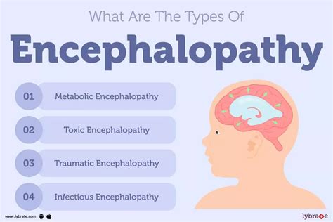 Encephalopathy Treatment Procedure Cost Recovery Side Effects And More