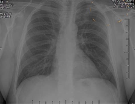 Week 2 Clinical Imaging Radiology X Rays Flashcards Quizlet