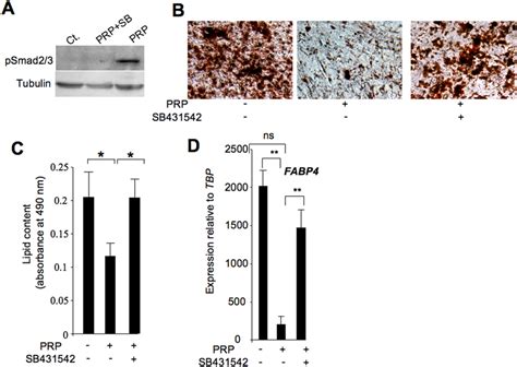 Tgf Pathway Inhibitor Sb Reversed Anti Adipogenic Prp Effects