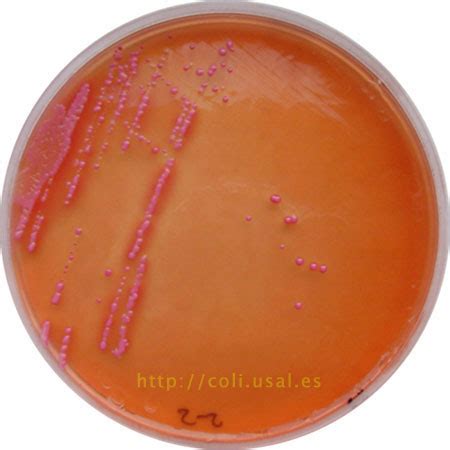 Investigaci N De Shigella