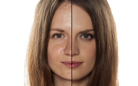 benefits  wrinkle reduction treatment  oily skin