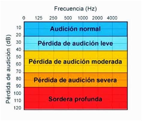 C Mo Se Realiza Una Audiometr A Blog De Aud Fono Es