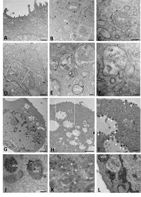 Immuno Electron Microscopy Showing Ace Localization In Mock Infected