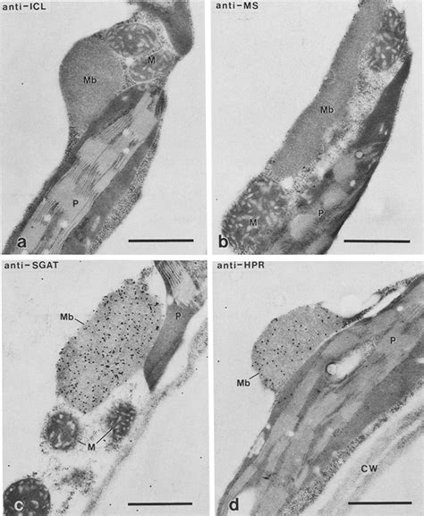 Immunocytochemical detection of peroxisomal enzymes, but not ...