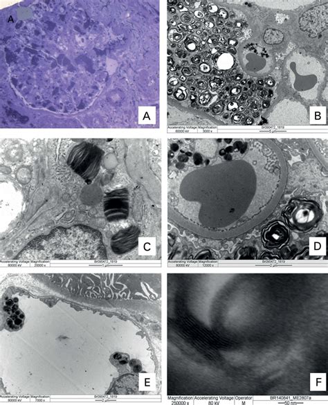 Specimen Embedded In Resin 05 µm Semi Thin Section Stained With Download Scientific Diagram