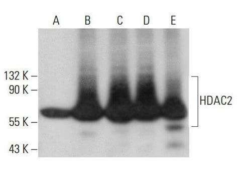 Anti Histone Deacetylase Hdac Antibody F Scbt Santa Cruz