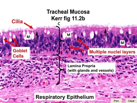 Respiratory Histology Flashcards Quizlet