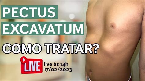 Pectus Excavatum Vacuum Bell Ou Cirurgia YouTube