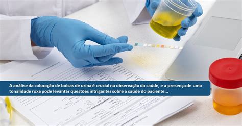 Teste Para Saber Se A Bolsa Estourou Ou É Urina