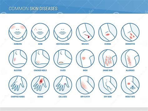 Common Skin Diseases Stock Vector Illustration Of Heel 42749056