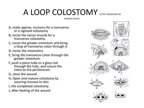 Colostomy | PPT | Free Download