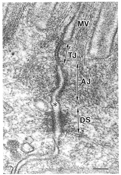 The Junctional Complex In Intestinal Epithelial Cells The Junctional