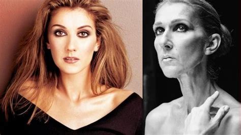 Irmã de Céline Dion faz triste revelação sobre grave estado de saúde da