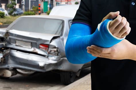 Car Accident Injuries Bone Fractures Waldorf Car Accidents