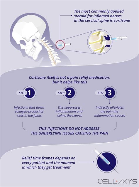 Cervical Epidural Steroid Injection Success Rates And Risks Cellaxys