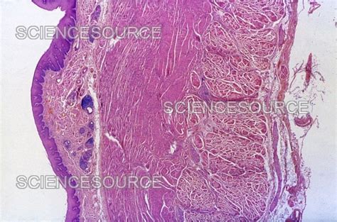 Squamous Epithelium of the Esophagus ( | Stock Image - Science Source ...