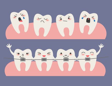 Teeth Braces Cartoon Images – Browse 5,726 Stock Photos, Vectors, and Video | Adobe Stock