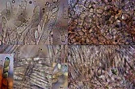 Botrytis cinerea - Mycologie microscopique - Mikroscopia