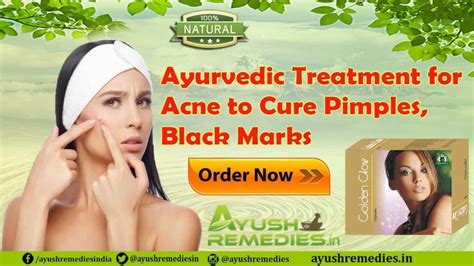 Ppt Ayurvedic Treatment For Acne To Cure Pimples Black Marks