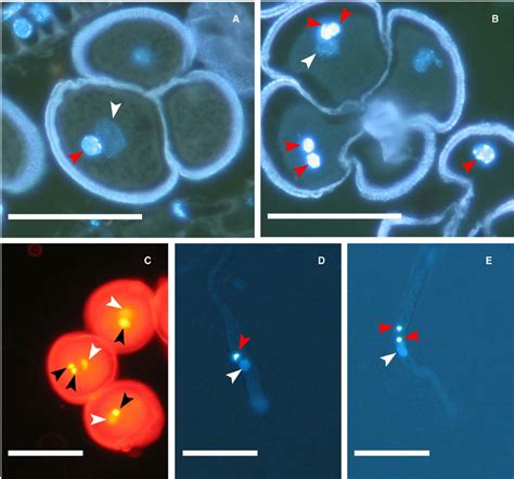 Fluorescence Micrographs Showing Number Of Nuclei In Pollen On The Fi