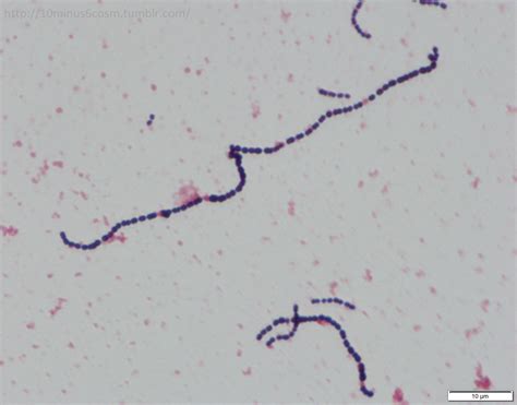 gram positive streptococci