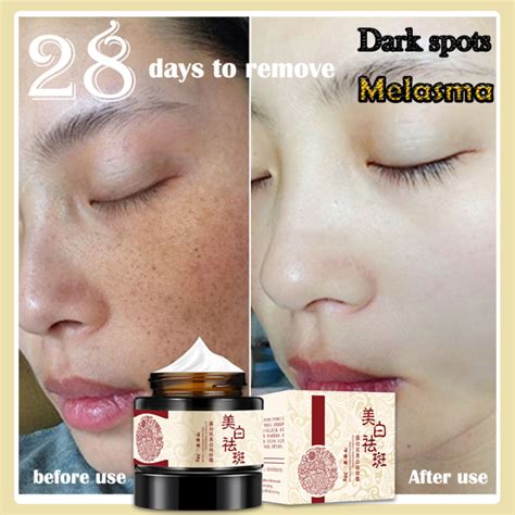 Whitening Freckle Remove Cream Reduce Pores Remove Dark