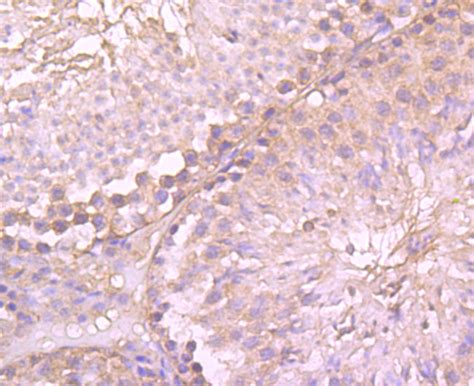 gamma tubulin monoclonal antibody   ma