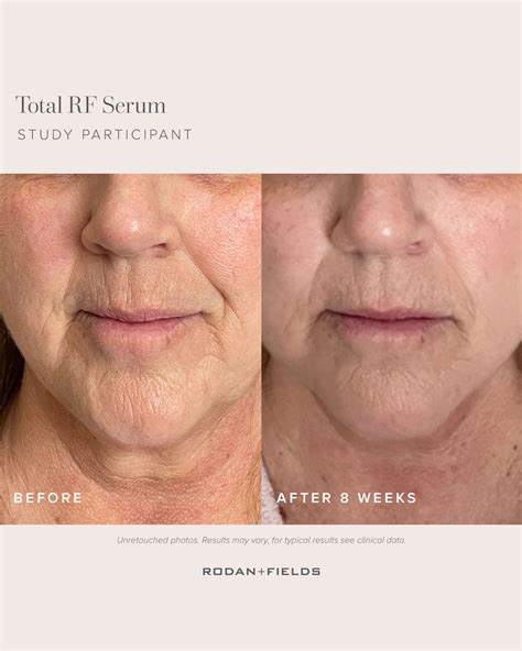 Dermatologist Inspired Skincare Products Rodan Fields® Artofit