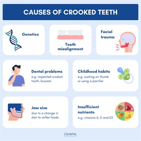 All About Crooked Teeth Causes Issues And Treatment Options