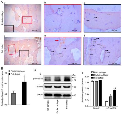 Osteocyte Tgfβ1‑smad2 3 Is Positively Associated With Bone Turnover Parameters In Subchondral