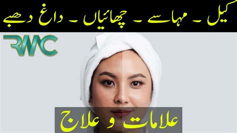 Keel Mahasay Aur Daane Skincare Dermatologist Rehman Medical Center Islamabad Blue