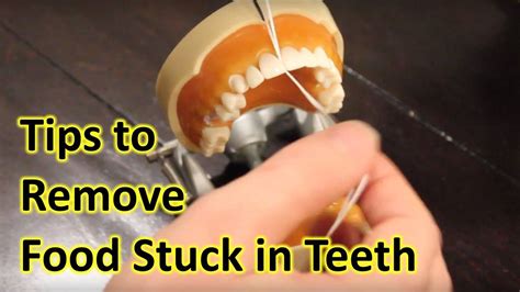 How To Remove Food Stuck In Teeth Food Dentistry How To Remove