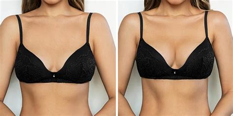 Breast Augmentation Nova Scotia Sydney Halifax Dr Atiyah