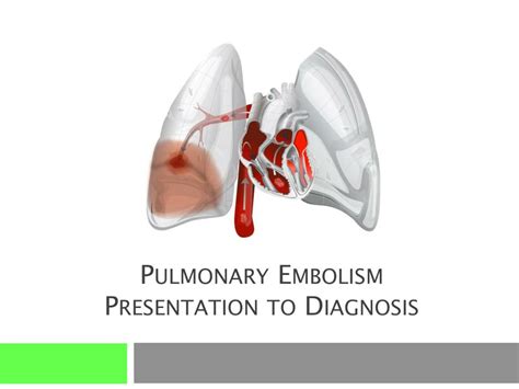 Ppt Pulmonary Embolism Presentation To Diagnosis Powerpoint Presentation Id 3209309