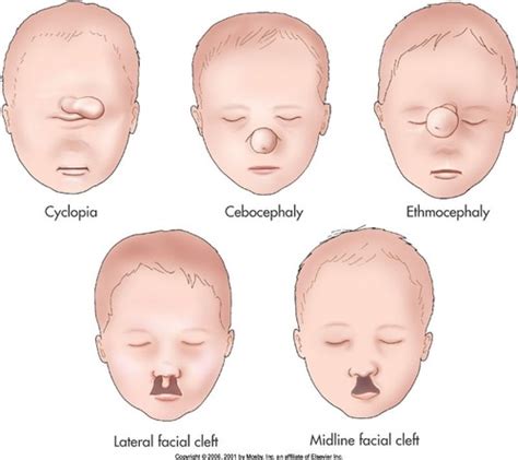 OBGYN Penny Review Chapter 25 Definitions Flashcards Quizlet