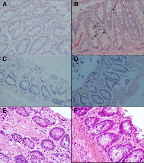 Representative Section Of Colon Architecture Histology Under The Light Download Scientific