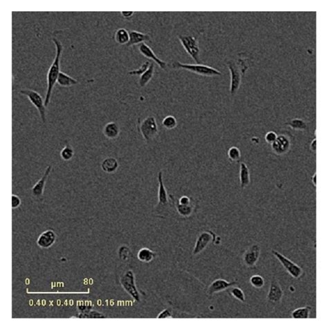 Morphology Of Hce T Cells Cultured For Hr On Fibroin Coated With