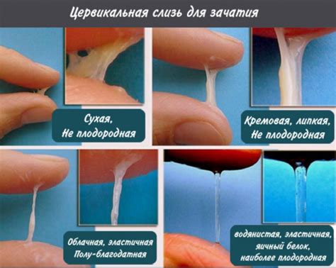 Proč dívky při vzrušení vylučují hlen hlavní důvody a mechanismy