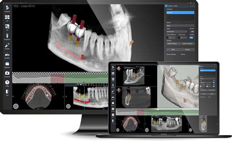 Software M Dico Hospitalar Implant D Medialab Para Cirurgia