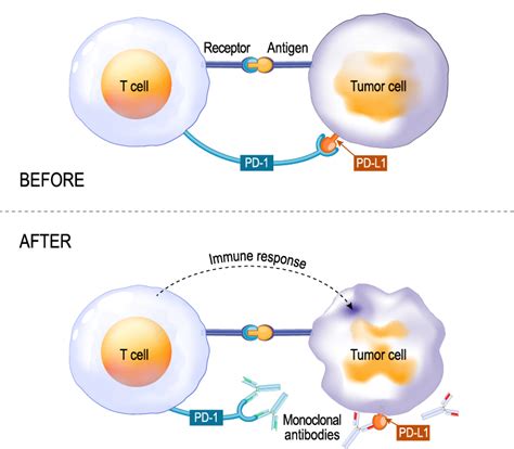 Blog Targeting Immune Checkpoints As Cancer Therapy